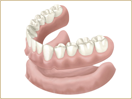 総入れ歯